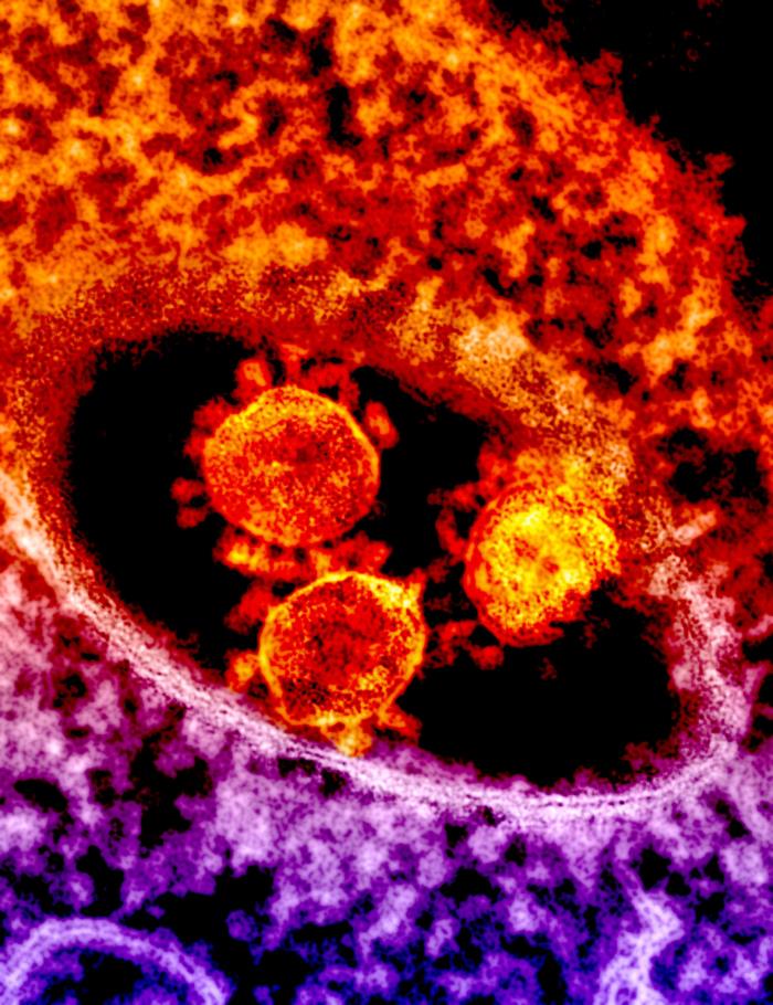 Coronavirus.jpg